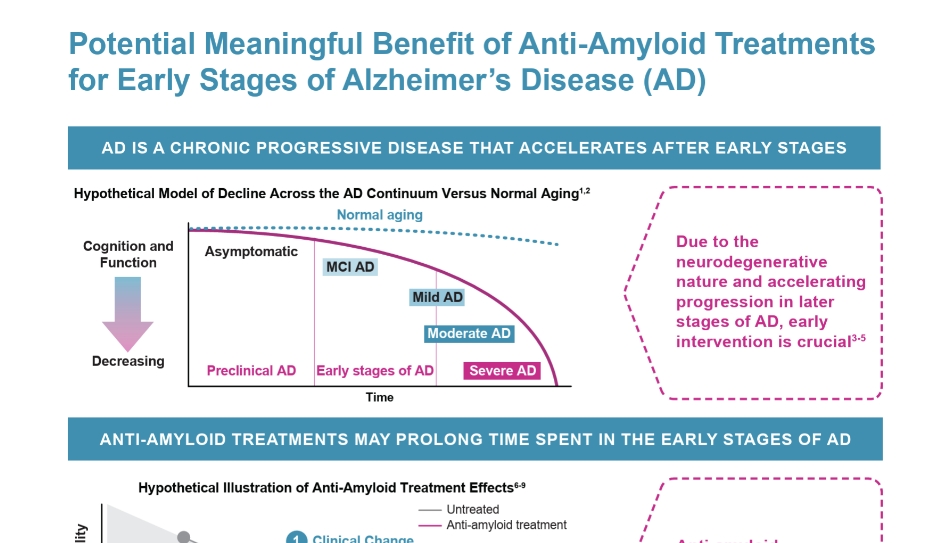 7 Stages Of Alzheimers Disease Infographic Alzheimers Dementia 960x540